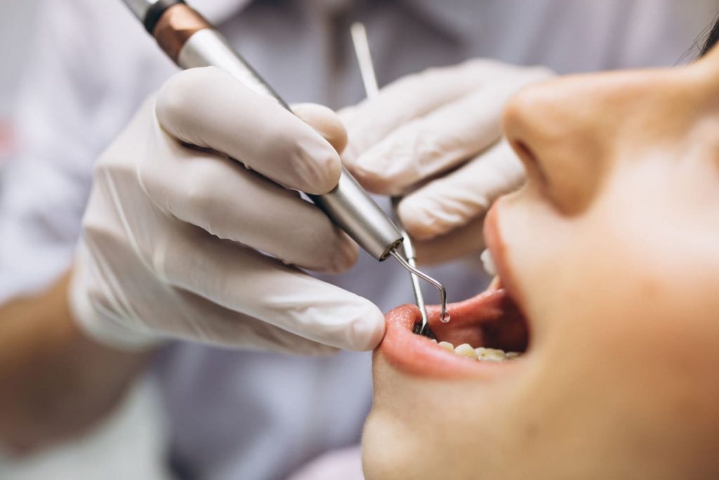 zubný lekár vyšetruje zuby na endodontickom vyšetrení